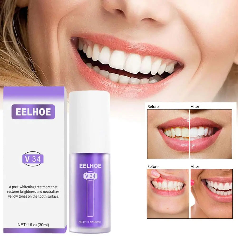 Mousse de Limpieza y Blanqueador Dental -30 ml Nuevo