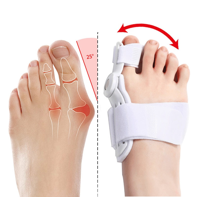 Corrector de Juanetes Para Dedos Hallux Valgus | Alivio del Dolor y Cuidado del Pie (2 Uds)